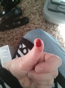 Cut thumb 1